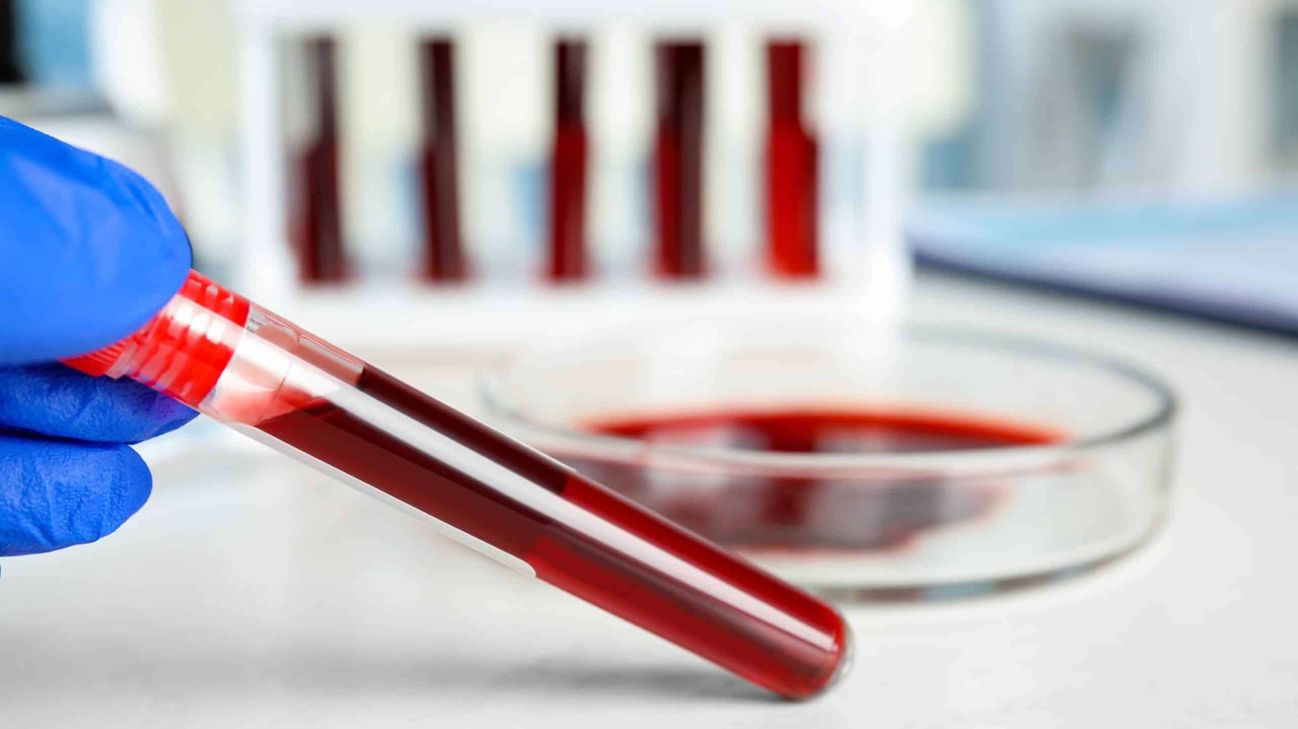 personalized blood work